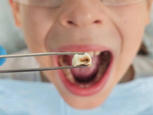 Best After-Hours Emergency Dentist in Taylor Lake Village, TX